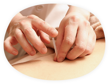 すべて使い捨ての鍼を使用し衛生面も安心